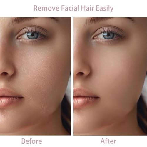 Battery-Operated Facial Hair Remover for Women