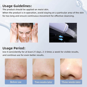 Professional Blackhead Remover & Pore Extraction Tool Set