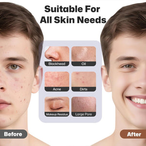Rechargeable Silicone Facial Cleansing & Massage Brush