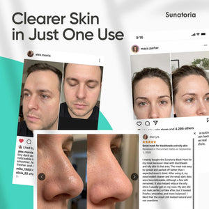 Charcoal Peel-Off Face Mask for Pore Cleansing & Oil Control