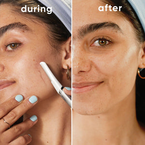 Dermaplaning Face Razor with 6 Replacement Blades